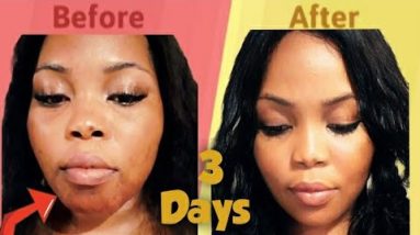 1770433608 hqdefault