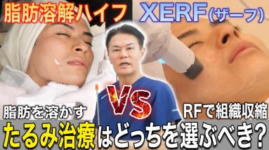 1770441225 maxresdefault