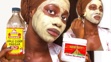 1770444884 maxresdefault