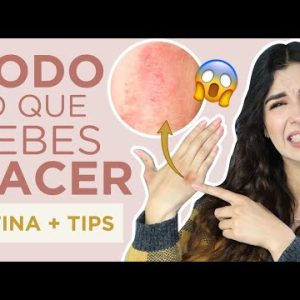 1770451512 hqdefault