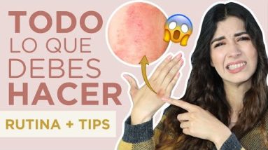 1770451512 hqdefault