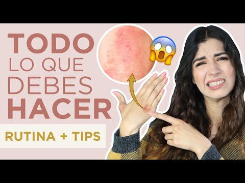 1770451512 hqdefault