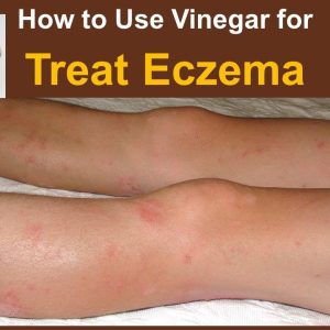 1770469776 maxresdefault