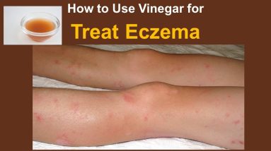 1770469776 maxresdefault