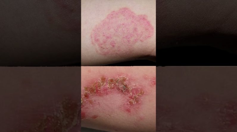 1770484497 maxresdefault