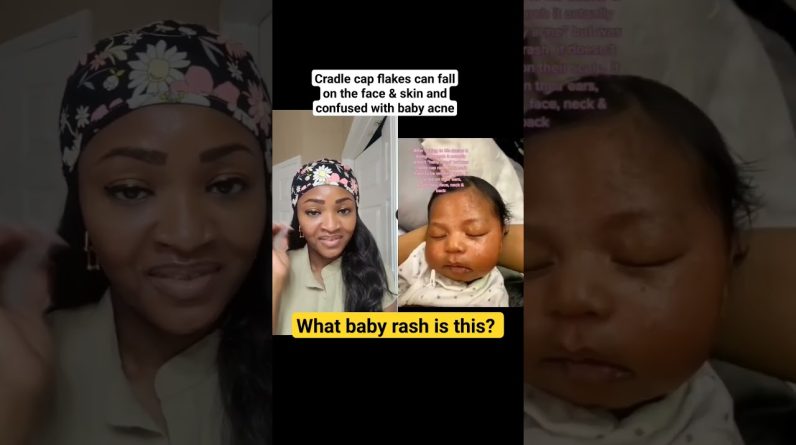 1770484981 maxresdefault