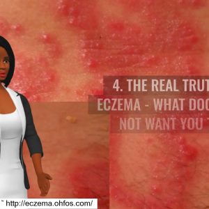 1770488144 maxresdefault