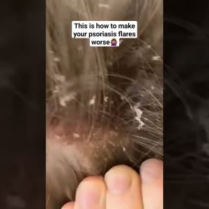 1770491809 maxresdefault