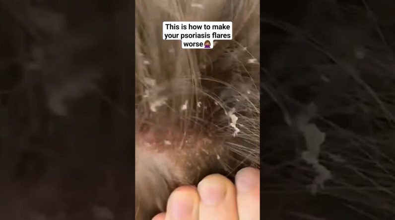 1770491809 maxresdefault