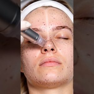 1770642287 maxresdefault