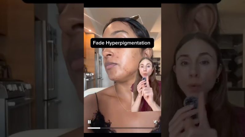 1770648538 maxresdefault