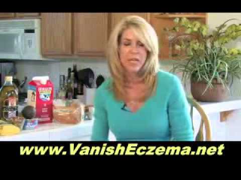 1770652982 hqdefault