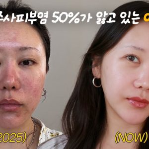 1770659742 maxresdefault