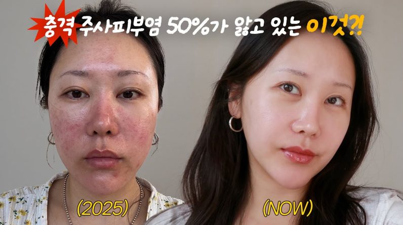 1770659742 maxresdefault