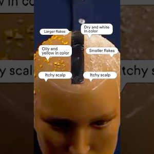 1770688974 maxresdefault