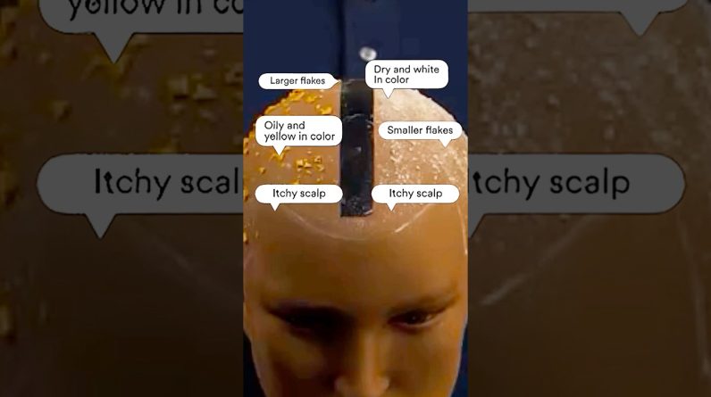 1770688974 maxresdefault