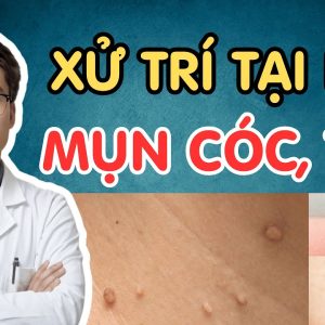 1770703606 maxresdefault