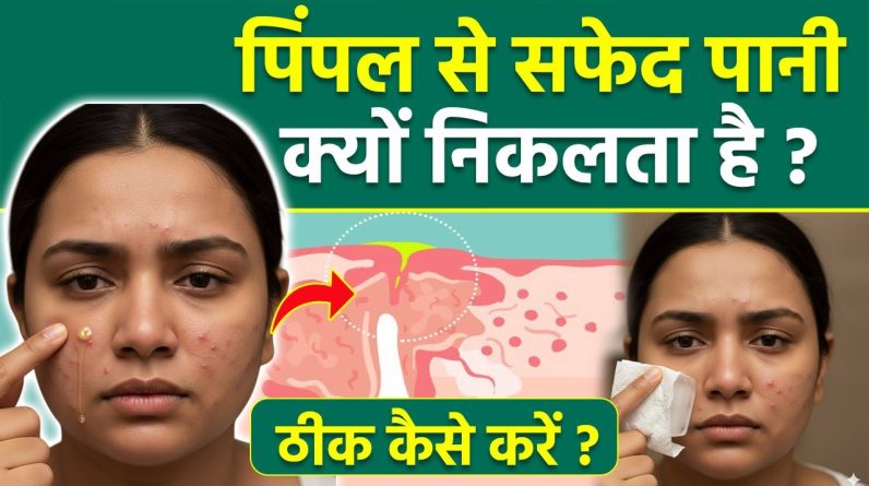 1770715244 maxresdefault