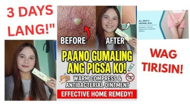 1770718309 hqdefault