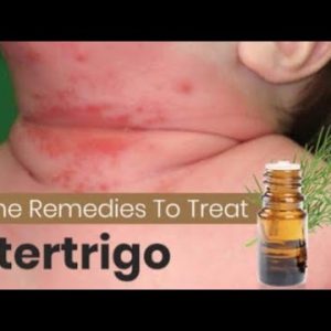 1770729163 hqdefault