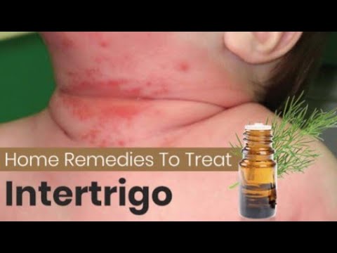 1770729163 hqdefault