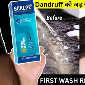 1770747558 maxresdefault