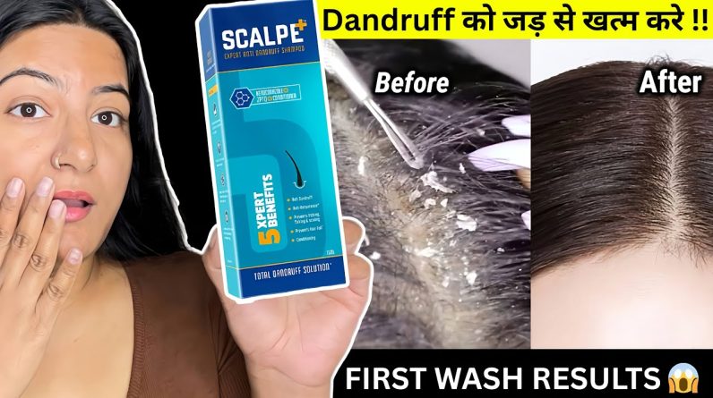 1770747558 maxresdefault