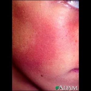 1770776806 hqdefault