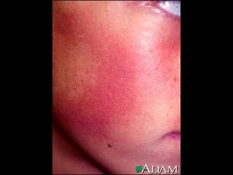 1770776806 hqdefault