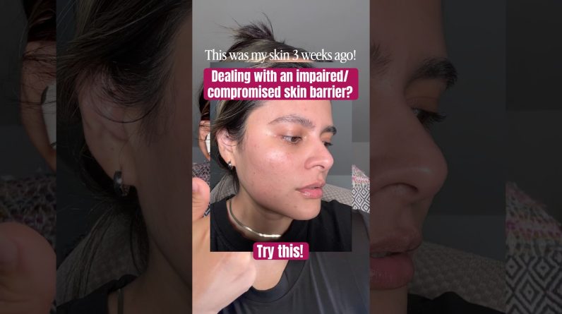 1770818029 maxresdefault