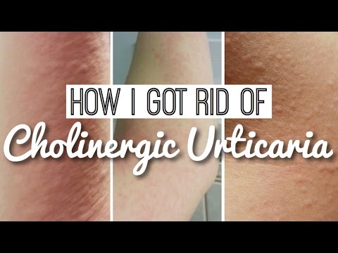 1770887567 hqdefault