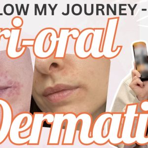 1770905146 maxresdefault