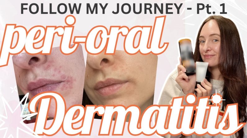 1770905146 maxresdefault