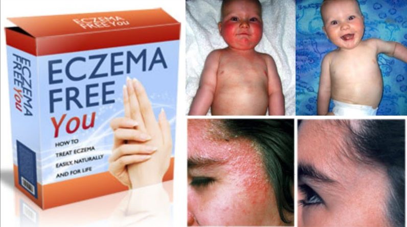 1770905628 maxresdefault