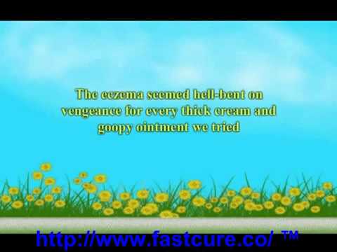 1770909284 hqdefault