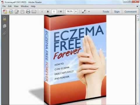 1770912945 hqdefault