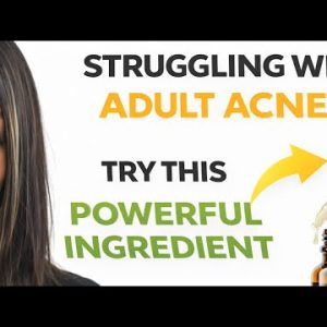 1770919599 hqdefault