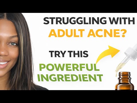 1770919599 hqdefault