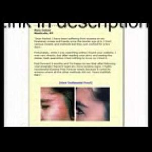 1770927585 hqdefault