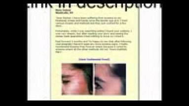 1770927585 hqdefault