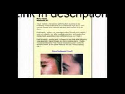 1770927585 hqdefault