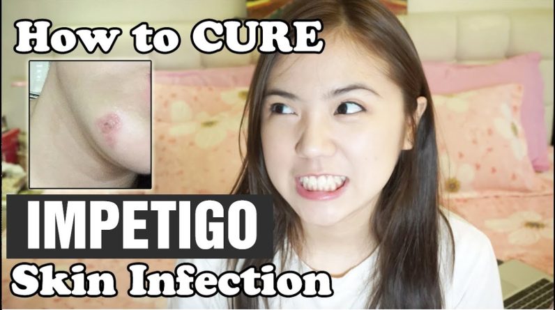 1770978927 maxresdefault