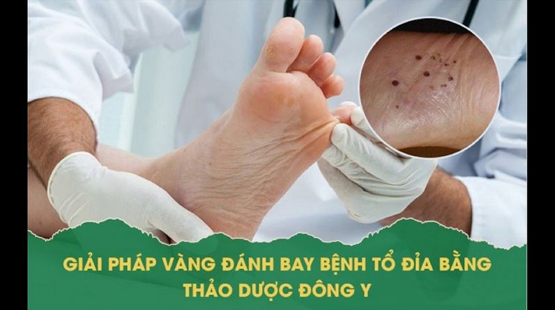 1770986321 maxresdefault