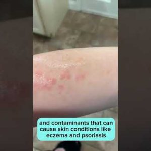 1770986404 hqdefault