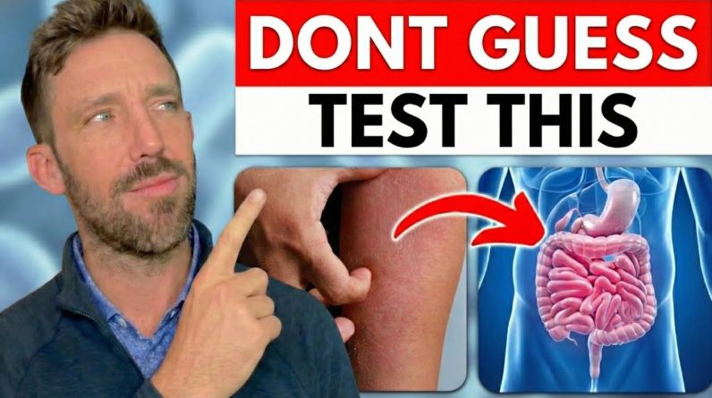 1770996718 maxresdefault