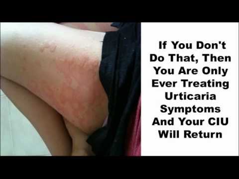 1770997349 hqdefault