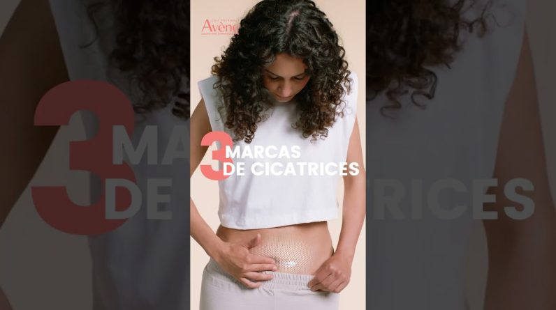 1771001125 maxresdefault