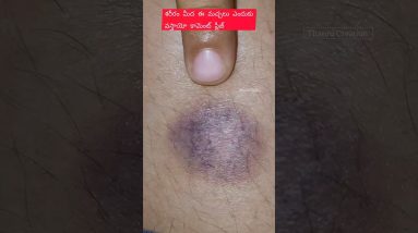 1771003801 maxresdefault