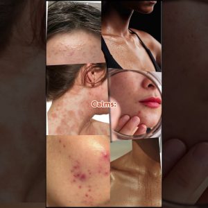 1771071342 maxresdefault