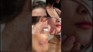 Your skin already knows how to heal.We just bottled it. 🤍 20 1771071342 maxresdefault